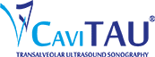 Logo CaviTAU