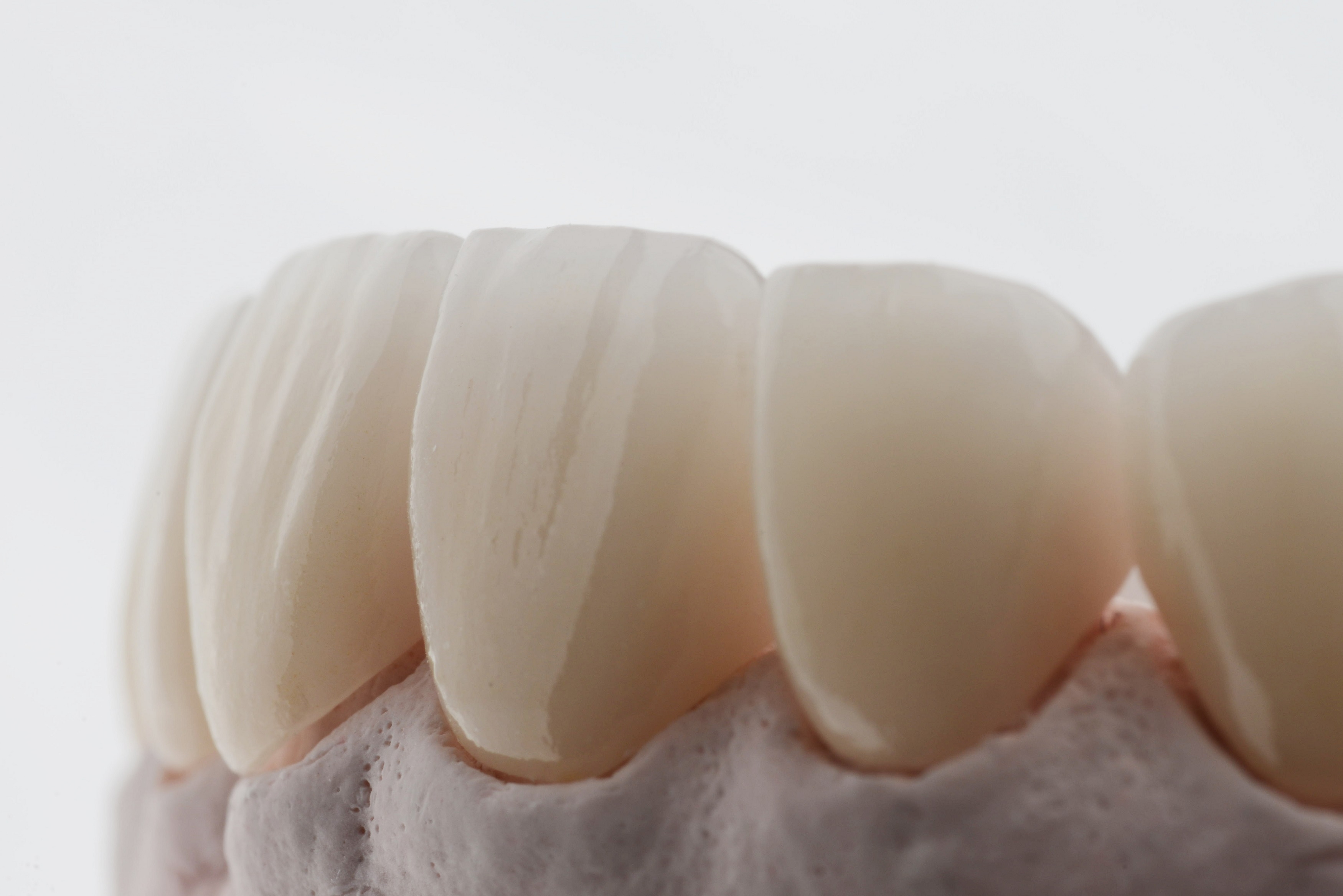 Veneers - Because efficient corrections don’t need to be visible.